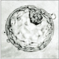 Imagen microscópica de blastocisto