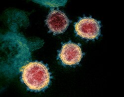 Imagen ilustrativa de SARS-CoV-2: El Virus Causante del COVID-19