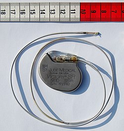 Imagen de dispositivo médico
