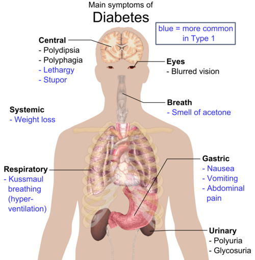 Signos y síntomas de la diabetes